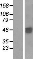 SAMD7 Human Over-expression Lysate