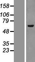 KAT5 Human Over-expression Lysate