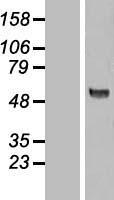 KAT5 Human Over-expression Lysate