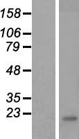 CREM Human Over-expression Lysate