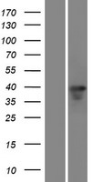 CHX10 (VSX2) Human Over-expression Lysate