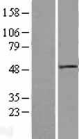 DVL1 Human Over-expression Lysate