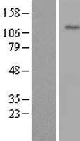 WDR72 Human Over-expression Lysate
