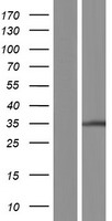 TPRG1L Human Over-expression Lysate