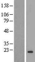 HEMK2 (N6AMT1) Human Over-expression Lysate