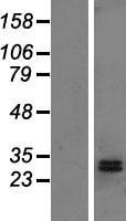 DHRS2 Human Over-expression Lysate