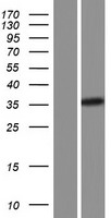 CREM Human Over-expression Lysate