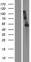 SPHK1 Human Over-expression Lysate