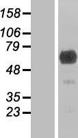 GEFT (ARHGEF25) Human Over-expression Lysate