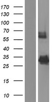 Acyl coenzyme A Thioesterase 8 (ACOT8) Human Over-expression Lysate