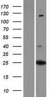 PXDC1 Human Over-expression Lysate