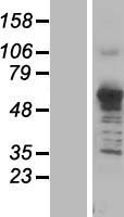 Asparagine synthetase (ASNS) Human Over-expression Lysate