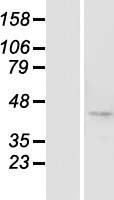 BTBD8 Human Over-expression Lysate