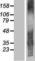 TMEM107 Human Over-expression Lysate