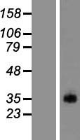 Marapsin2 (PRSS38) Human Over-expression Lysate
