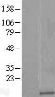 TMSB4XP8 Human Over-expression Lysate