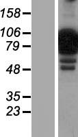 NCKIPSD Human Over-expression Lysate