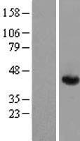 Aldolase (ALDOA) Human Over-expression Lysate