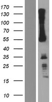 IKZF3 Human Over-expression Lysate