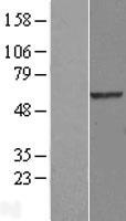 B3GALTL (B3GLCT) Human Over-expression Lysate