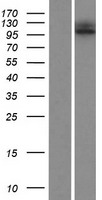 ESPNL Human Over-expression Lysate