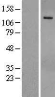PHLPP (PHLPP1) Human Over-expression Lysate