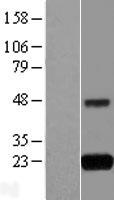 GNPNAT1 Human Over-expression Lysate
