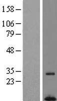 C7orf55 (FMC1) Human Over-expression Lysate