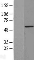 ZFP200 (ZNF200) Human Over-expression Lysate