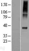 CATSPER4 Human Over-expression Lysate