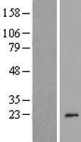 TREML4 Human Over-expression Lysate