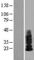 SHISA4 Human Over-expression Lysate