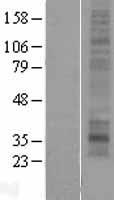 MMD2 Human Over-expression Lysate