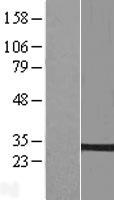 PTPLB (HACD2) Human Over-expression Lysate