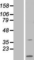 ARPP21 Human Over-expression Lysate