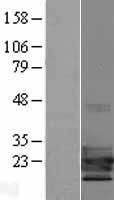 TCF21 Human Over-expression Lysate
