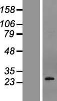 PDPN Human Over-expression Lysate