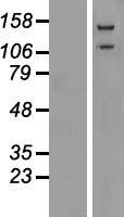 alpha Glucosidase II (GANAB) Human Over-expression Lysate