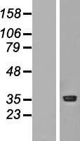 PRMT1 Human Over-expression Lysate