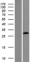 CIDE A (CIDEA) Human Over-expression Lysate