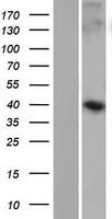 WDR86 Human Over-expression Lysate