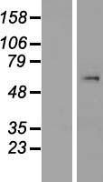 SMYD1 Human Over-expression Lysate