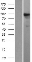 HIPK1 Human Over-expression Lysate