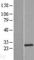 SNRPB2 Human Over-expression Lysate