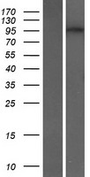 DENND2C Human Over-expression Lysate