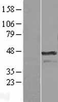 Aurora A (AURKA) Human Over-expression Lysate