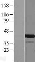 CENATAC Human Over-expression Lysate