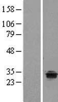 TPRG1 Human Over-expression Lysate