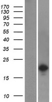 SH2D6 Human Over-expression Lysate