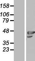 OLFML1 Human Over-expression Lysate